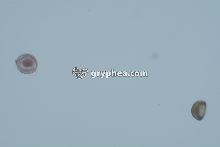 Taenia saginata, oeufs dans déjections x100 - gryphea.org